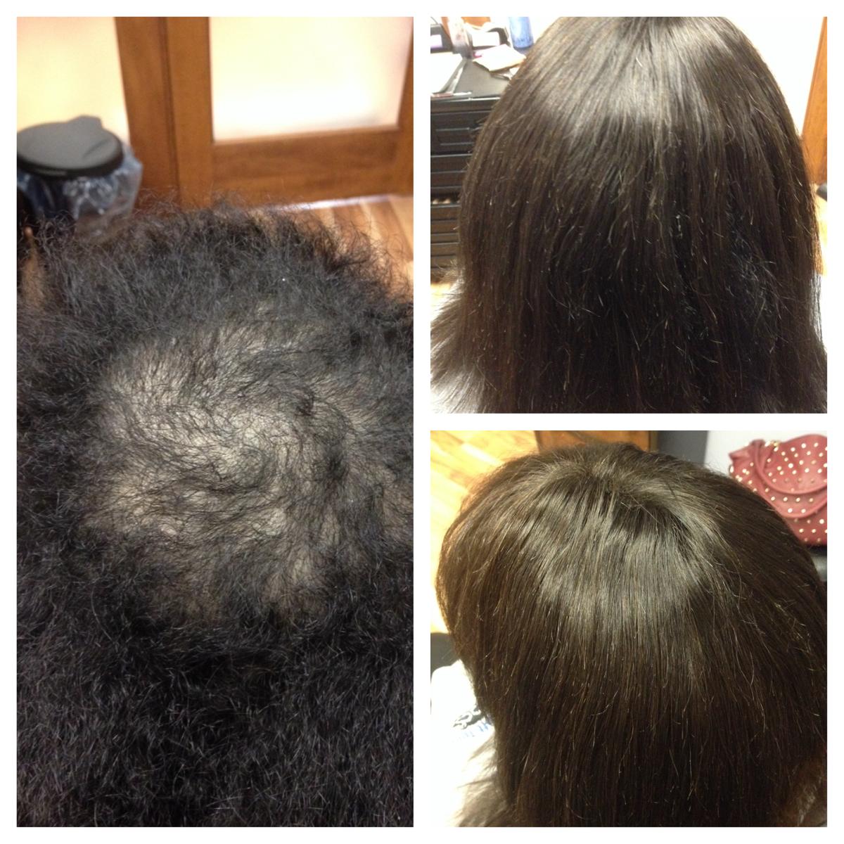 Hair systems, wigs and non-surgical hair loss solutions – LTS Hair Studio