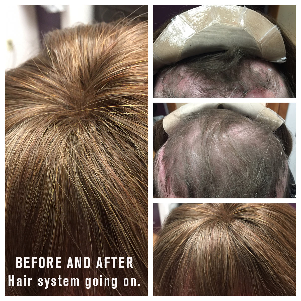 Hair System - Before and After