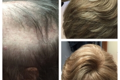 Hair System - Before and After