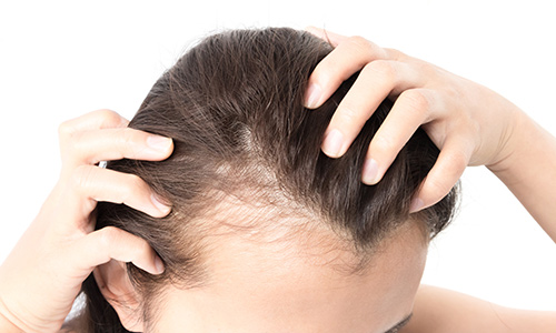 LTS Hair Studio Hair Loss Solutions